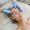 mesotherapy2